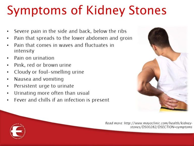 kidney stone pain relief at home kidney stone early symptoms how to get rid of kidney stones kidney stone causes kidney stones pictures how long does it take to pass a kidney stone kidney stones diet passing a kidney stone