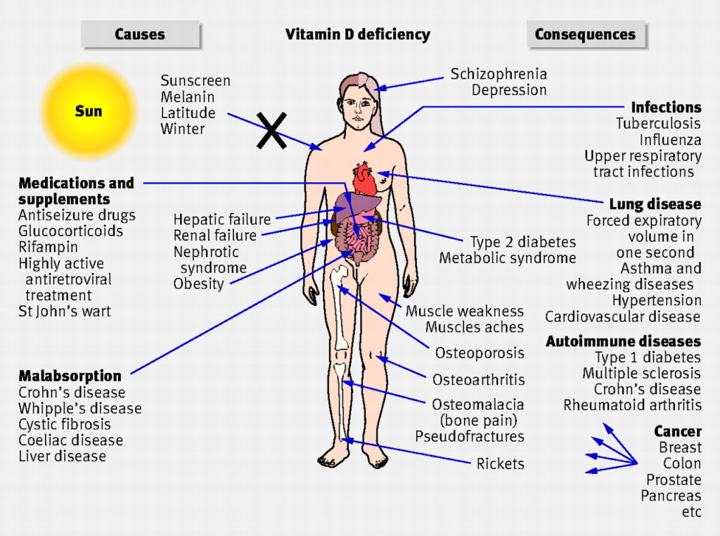 vitamin d diseases