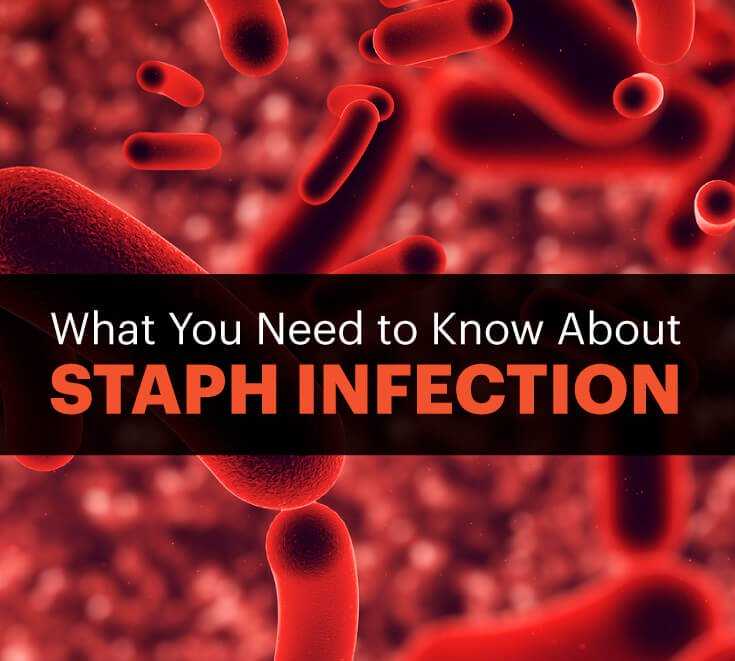 symptoms, signs of Staph Infection