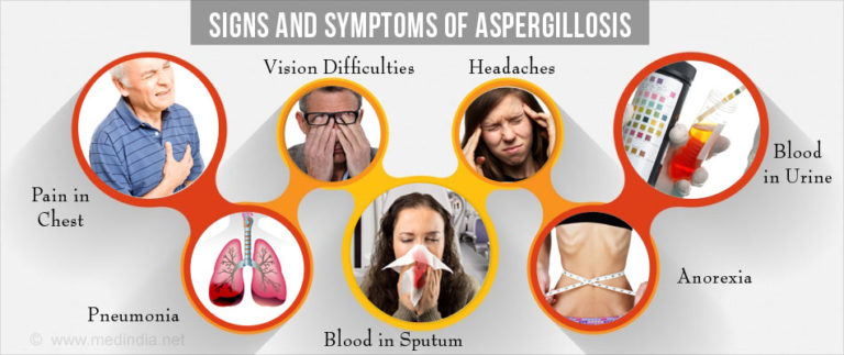 Aspergillosis Causes, Symptoms, Prevention and Treatment