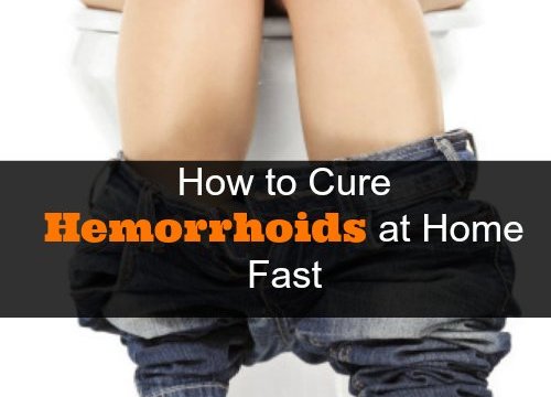 Home Remedy For Hemorrhoids