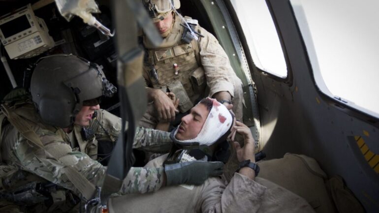among veterans is traumatic brain injuries